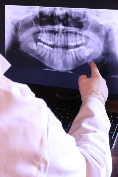 Best Knocked-Out Tooth Emergency  in Fairfield, IL